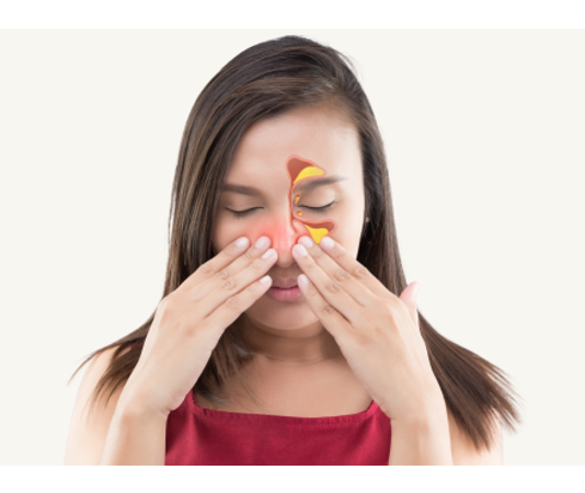 Clearing the Air: Debunking Common Myths About Sinusitis