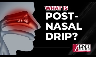 Post-Nasal Drip