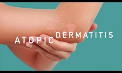 Dermatitis