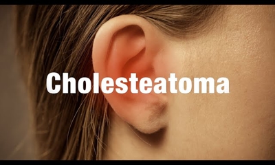 Cholesteatoma