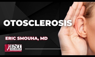 Otosclerosis
