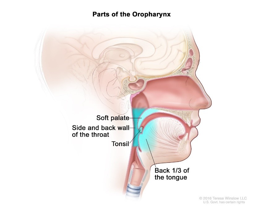 What is Oropharyngeal Cancer?