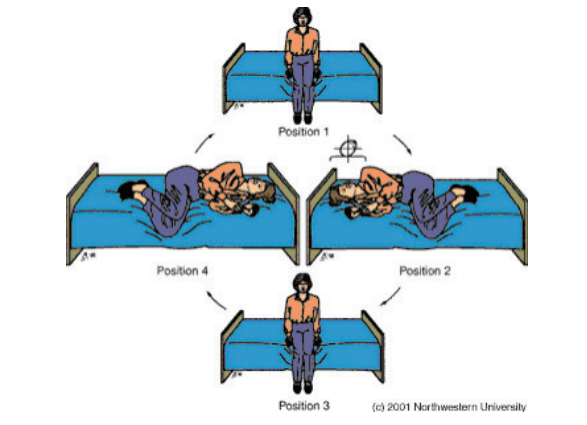 Brandt-Daroff exercises diagram
